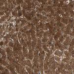 ZNF323 Antibody in Immunohistochemistry (Paraffin) (IHC (P))