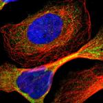 ADNP2 Polyclonal Antibody