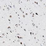 ADNP2 Antibody in Immunohistochemistry (Paraffin) (IHC (P))