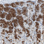 ADNP2 Antibody in Immunohistochemistry (Paraffin) (IHC (P))