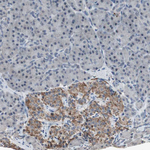 ADNP2 Antibody in Immunohistochemistry (Paraffin) (IHC (P))