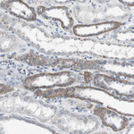 ADNP2 Antibody in Immunohistochemistry (Paraffin) (IHC (P))