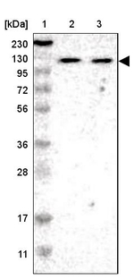 ADNP2 Antibody in Western Blot (WB)
