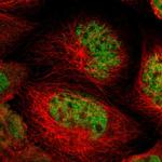 NFRKB Polyclonal Antibody