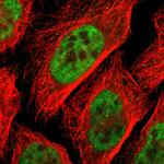 ZFC3H1 Polyclonal Antibody