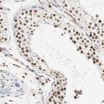 ZFC3H1 Antibody in Immunohistochemistry (IHC)