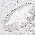 ZFC3H1 Antibody in Immunohistochemistry (IHC)