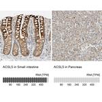 ACSL5 Antibody in Immunohistochemistry (IHC)