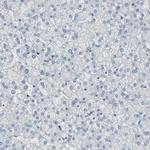 DMPK Antibody in Immunohistochemistry (Paraffin) (IHC (P))