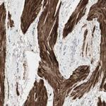 DMPK Antibody in Immunohistochemistry (IHC)