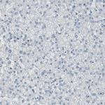 DMPK Antibody in Immunohistochemistry (IHC)