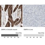 DMPK Antibody