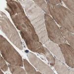 DMPK Antibody in Immunohistochemistry (IHC)