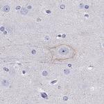 CDH9 Polyclonal Antibody