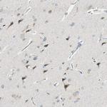 PCDHB15 Polyclonal Antibody