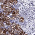 PTPRN Antibody in Immunohistochemistry (IHC)