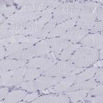 PTPRN Antibody in Immunohistochemistry (IHC)