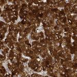 PTPRN Antibody in Immunohistochemistry (IHC)