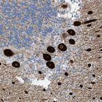 SERCA3 ATPase Polyclonal Antibody