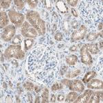 SULT1C2 Antibody in Immunohistochemistry (Paraffin) (IHC (P))
