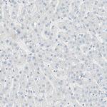 SULT1C2 Antibody in Immunohistochemistry (Paraffin) (IHC (P))