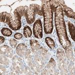 SULT1C2 Antibody in Immunohistochemistry (Paraffin) (IHC (P))