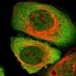 CYTIP Polyclonal Antibody