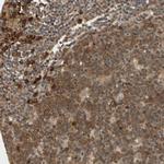 CYTIP Antibody in Immunohistochemistry (IHC)