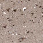 KANSL1 Antibody in Immunohistochemistry (Paraffin) (IHC (P))