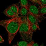 FAM198B Polyclonal Antibody