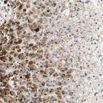 FAM198B Antibody in Immunohistochemistry (Paraffin) (IHC (P))
