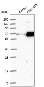 FAM198B Antibody in Western Blot (WB)