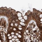 ZNF690 Antibody in Immunohistochemistry (IHC)