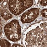ZNF690 Antibody in Immunohistochemistry (IHC)