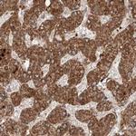 ZNF690 Antibody in Immunohistochemistry (IHC)