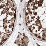 ZNF690 Antibody in Immunohistochemistry (IHC)