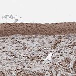 ZNF690 Polyclonal Antibody