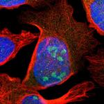 SCAND3 Polyclonal Antibody