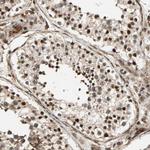 SCAND3 Antibody in Immunohistochemistry (Paraffin) (IHC (P))