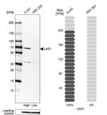 LAD1 Antibody in Western Blot (WB)