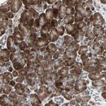 PGBD1 Antibody in Immunohistochemistry (Paraffin) (IHC (P))