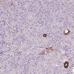SCTR Antibody in Immunohistochemistry (Paraffin) (IHC (P))