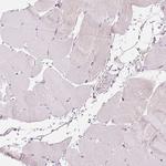 SCTR Antibody in Immunohistochemistry (Paraffin) (IHC (P))