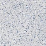 SPINK4 Antibody in Immunohistochemistry (IHC)