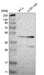 ZSCAN30 Antibody in Western Blot (WB)