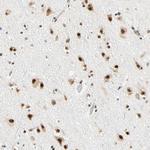 ZNF435 Antibody in Immunohistochemistry (Paraffin) (IHC (P))