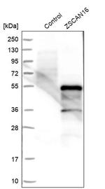 ZNF435 Antibody in Western Blot (WB)