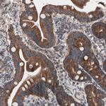 CTTNBP2NL Antibody in Immunohistochemistry (Paraffin) (IHC (P))
