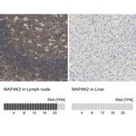 MAP4K2 Antibody in Immunohistochemistry (IHC)