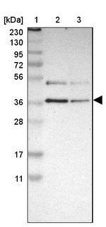 GALE Antibody in Western Blot (WB)